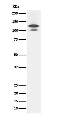 Anti-RASA1 Rabbit Monoclonal Antibody Boster Bio