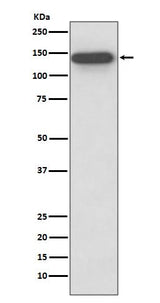 Anti-SMC3 Rabbit Monoclonal Antibody Boster Bio