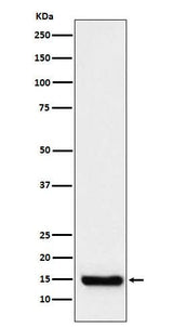 Anti-TTC11 Rabbit Monoclonal Antibody Boster Bio