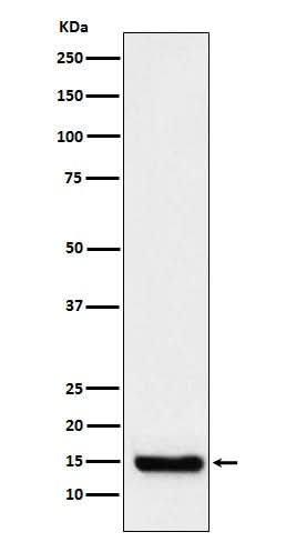 Anti-TTC11 Rabbit Monoclonal Antibody Boster Bio