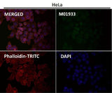 Anti-Integrin alpha 2 ITGA2 Rabbit Monoclonal Antibody Boster Bio