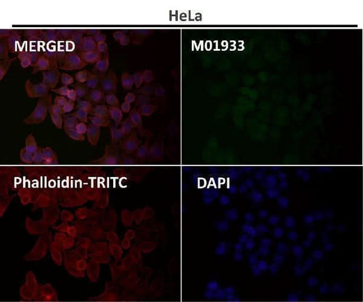 Anti-Integrin alpha 2 ITGA2 Rabbit Monoclonal Antibody Boster Bio