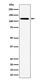 Anti-KIF5B Rabbit Monoclonal Antibody Boster Bio