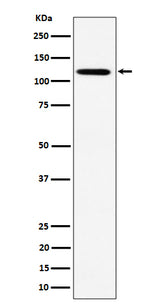 Anti-KIF5B Rabbit Monoclonal Antibody Boster Bio