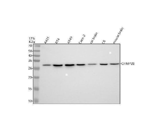 Anti-CHMP2B Rabbit Monoclonal Antibody Boster Bio