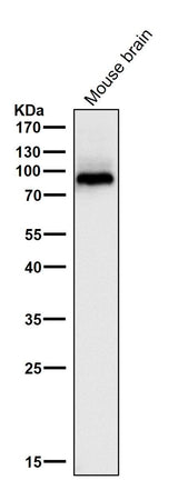 Anti-PKC beta 1 Rabbit Monoclonal Antibody Boster Bio