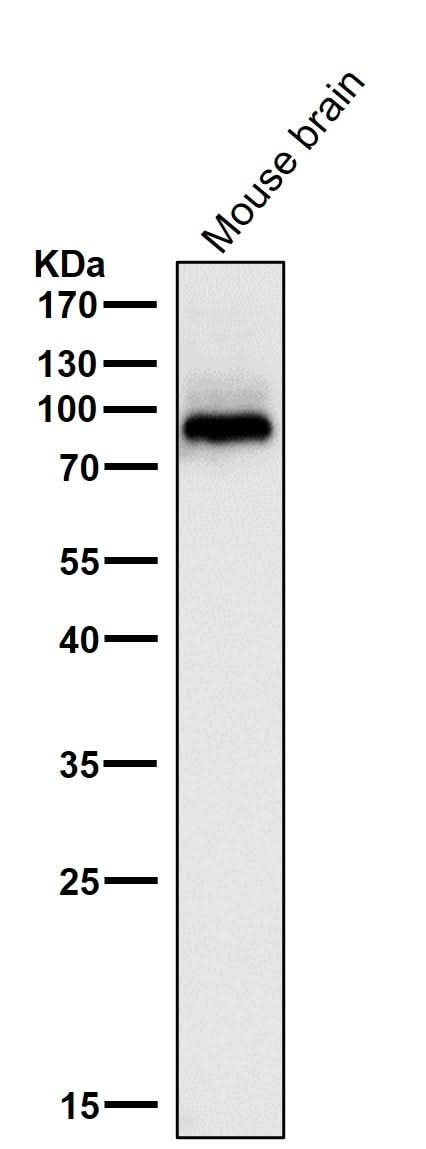 Anti-PKC beta 1 Rabbit Monoclonal Antibody Boster Bio