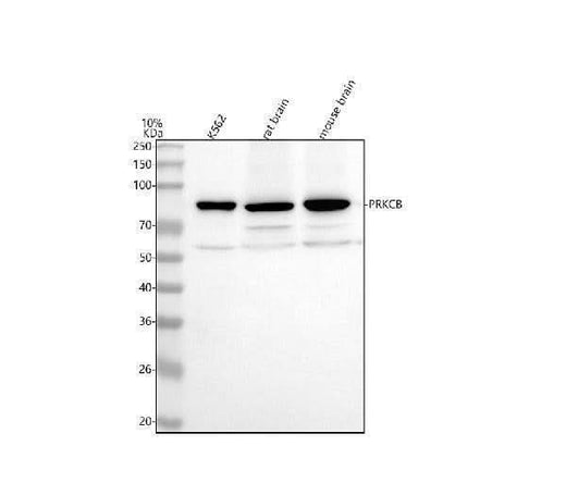 Anti-PKC beta 2 PRKCB Rabbit Monoclonal Antibody Boster Bio