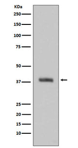 Anti-HTRA2/Omi Rabbit Monoclonal Antibody Boster Bio