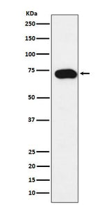 Anti-SLC22A1 Rabbit Monoclonal Antibody Boster Bio