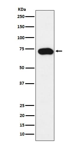 Anti-SLC22A1 Rabbit Monoclonal Antibody Boster Bio