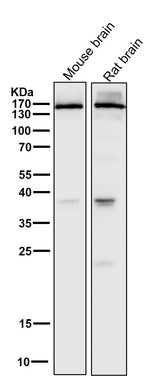 Anti-NMDAR2A Rabbit Monoclonal Antibody Boster Bio