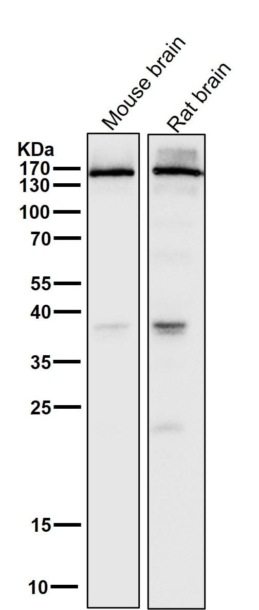 Anti-NMDAR2A Rabbit Monoclonal Antibody Boster Bio