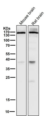 Anti-NMDAR2A Rabbit Monoclonal Antibody Boster Bio