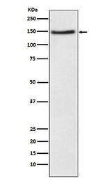 Anti-NPC1L1 Rabbit Monoclonal Antibody Boster Bio