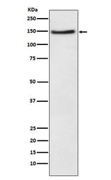 Anti-NPC1L1 Rabbit Monoclonal Antibody Boster Bio