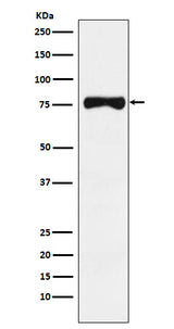 Anti-TRP1 Monoclonal Antibody Boster Bio