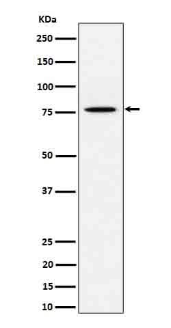 Anti-PSIP1 / LEDGF Rabbit Monoclonal Antibody Boster Bio