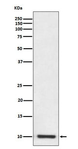 Anti-S100P Rabbit Monoclonal Antibody Boster Bio