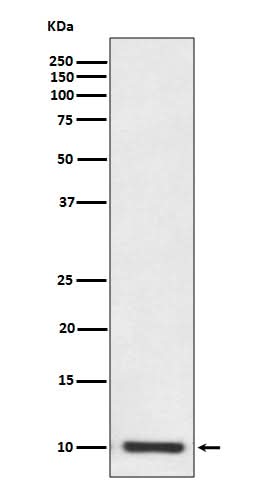 Anti-S100P Rabbit Monoclonal Antibody Boster Bio
