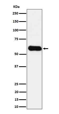 Anti-CD275 Rabbit Monoclonal Antibody Boster Bio