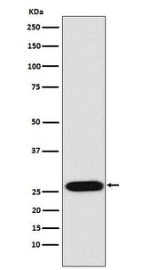 Anti-LIN28 LIN28A Monoclonal Antibody Boster Bio