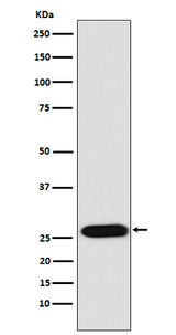 Anti-LIN28 LIN28A Monoclonal Antibody Boster Bio