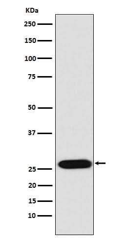 Anti-LIN28 LIN28A Monoclonal Antibody Boster Bio