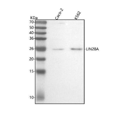 Anti-Lin28 LIN28A Rabbit Monoclonal Antibody Boster Bio