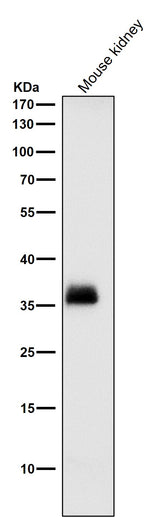 Anti-SFRP1 Rabbit Monoclonal Antibody Boster Bio