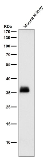 Anti-SFRP1 Rabbit Monoclonal Antibody Boster Bio