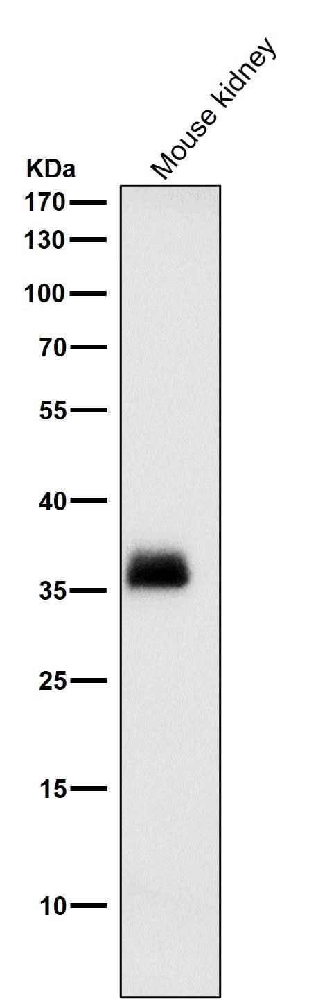 Anti-SFRP1 Rabbit Monoclonal Antibody Boster Bio