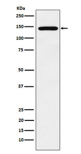 Anti-Jarid2 Rabbit Monoclonal Antibody Boster Bio
