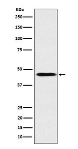 Anti-ApoA4 Rabbit Monoclonal Antibody Boster Bio