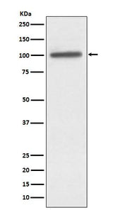 Anti-alpha Actinin 4 ACTN4 Monoclonal Antibody Boster Bio
