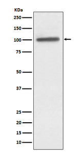 Anti-alpha Actinin 4 ACTN4 Monoclonal Antibody Boster Bio