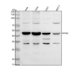 Anti-RRM2 Monoclonal Antibody Boster Bio