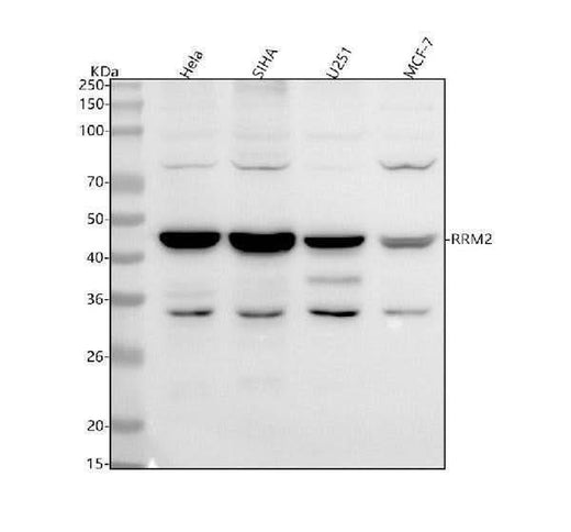 Anti-RRM2 Monoclonal Antibody Boster Bio