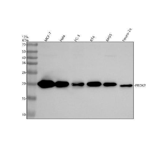 Anti-Peroxiredoxin 2 Rabbit Monoclonal Antibody Boster Bio