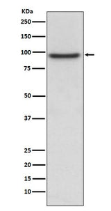 Anti-PROX1 Rabbit Monoclonal Antibody Boster Bio