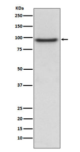 Anti-PROX1 Rabbit Monoclonal Antibody Boster Bio