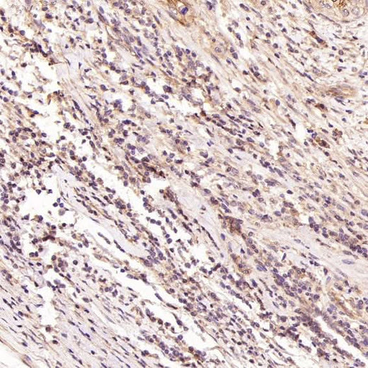 Anti-H Cadherin Rabbit Monoclonal Antibody Boster Bio
