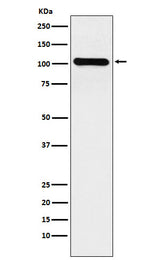 Anti-BACH1/BRIP1 Rabbit Monoclonal Antibody Boster Bio