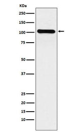 Anti-BACH1/BRIP1 Rabbit Monoclonal Antibody Boster Bio