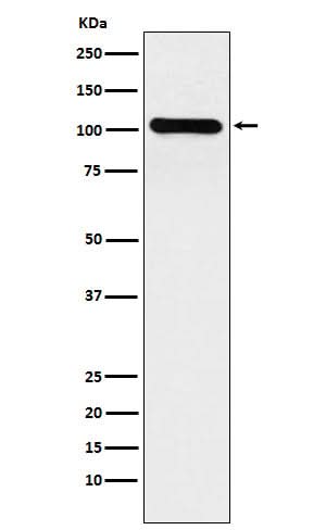 Anti-BACH1/BRIP1 Rabbit Monoclonal Antibody Boster Bio