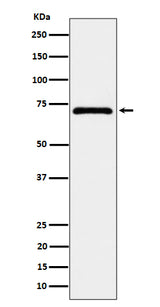 Anti-EPHX2 Rabbit Monoclonal Antibody Boster Bio