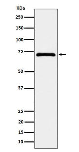 Anti-EPHX2 Rabbit Monoclonal Antibody Boster Bio