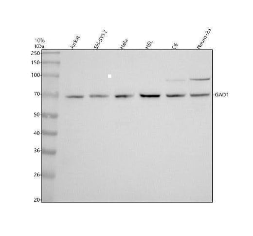 Anti-GAD67 GAD1 Rabbit Monoclonal Antibody Boster Bio