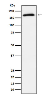 Anti-Phospho-AS160 (T642) Rabbit Monoclonal Antibody Boster Bio