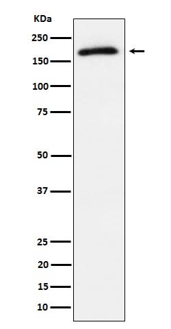 Anti-Phospho-AS160 (T642) Rabbit Monoclonal Antibody Boster Bio